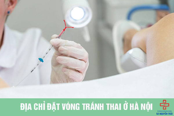 Địa chỉ đặt vòng tránh thai ở Hà Nội